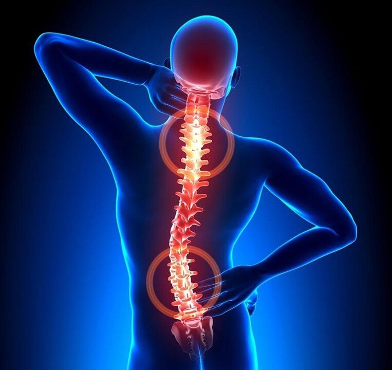 остеохондроз позвоночника как причина болей в спине