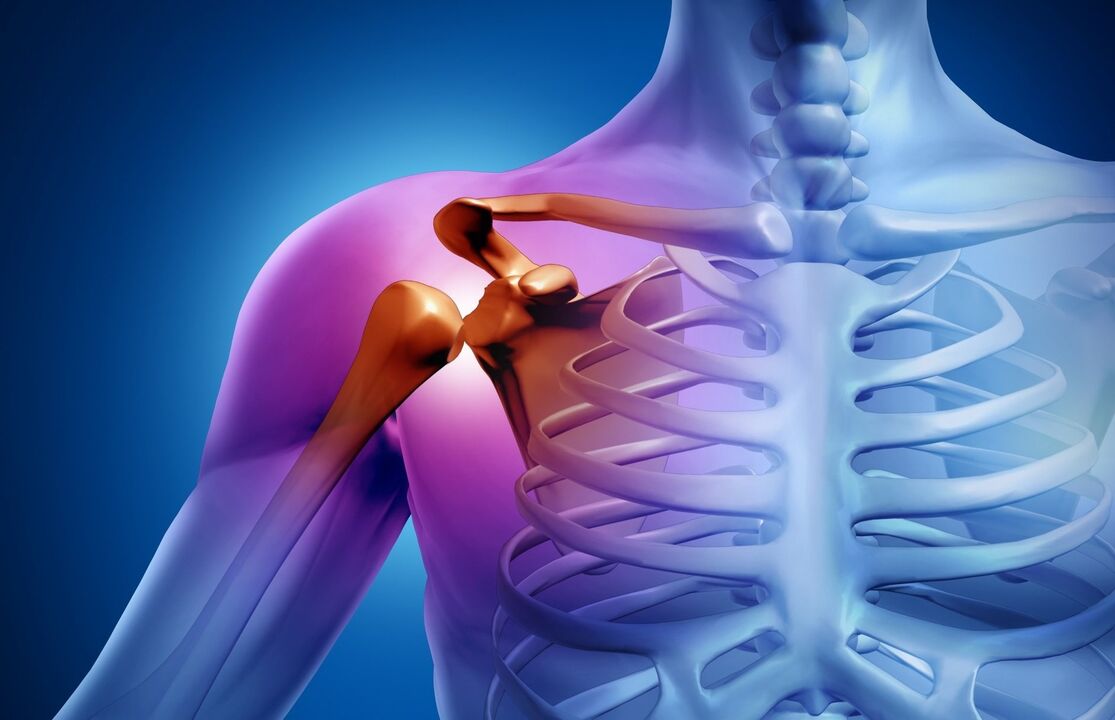 плечевой остеоартрит